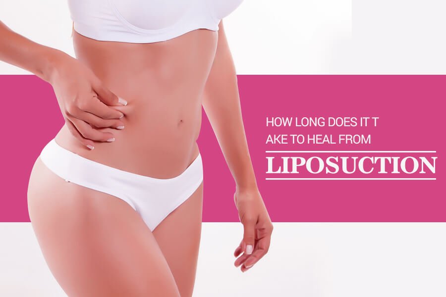 How Long Does It Take to Heal from Liposuction?