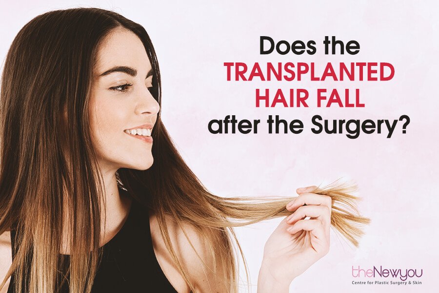 Does the Transplanted Hair Fall after the Surgery