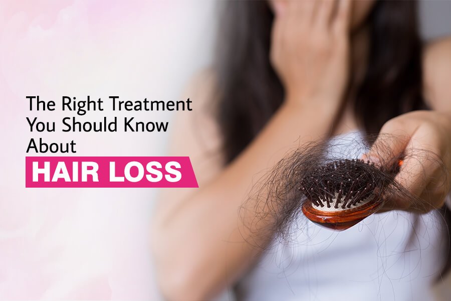 The Right Treatment You Should Know About Hair Loss