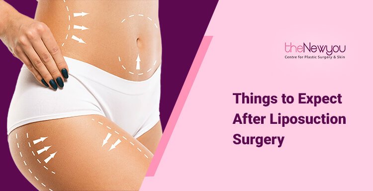 things to expect after liposuction