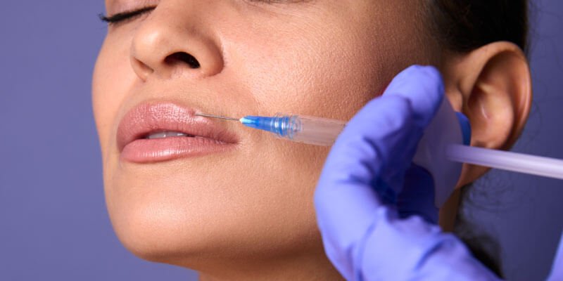 A permanent method of lip augmenting