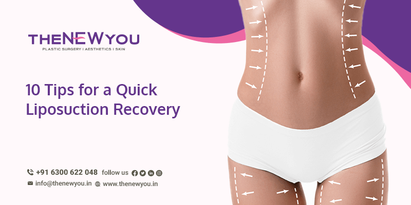 Your Laser Liposuction Recovery Guide