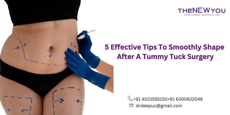 5 Effective Tips To Smoothly Shape After A Tummy Tuck Surgery