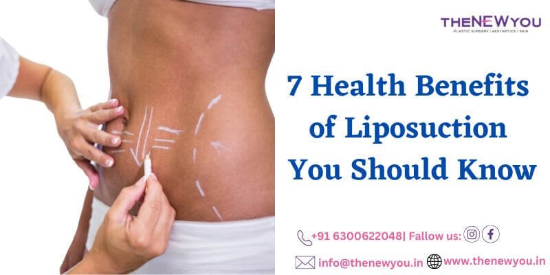 7 Key Benefits of Liposuction Surgery You Should Know