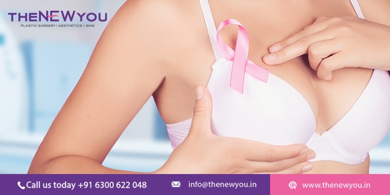 Oncoplastic Breast Surgery