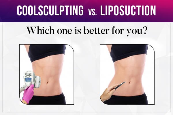 CoolSculpting® vs. Liposuction vs. Tummy Tuck: Recovery Time & Results  (Pictures)