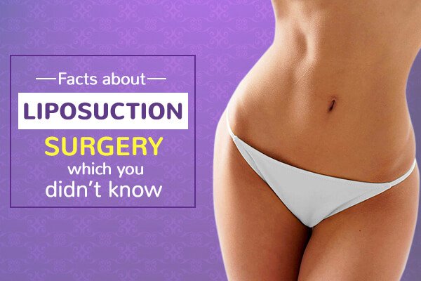 Facts about Liposuction Surgery