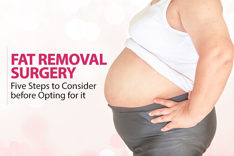 Fat Removal Surgery – Five Steps to Consider before Opting for it