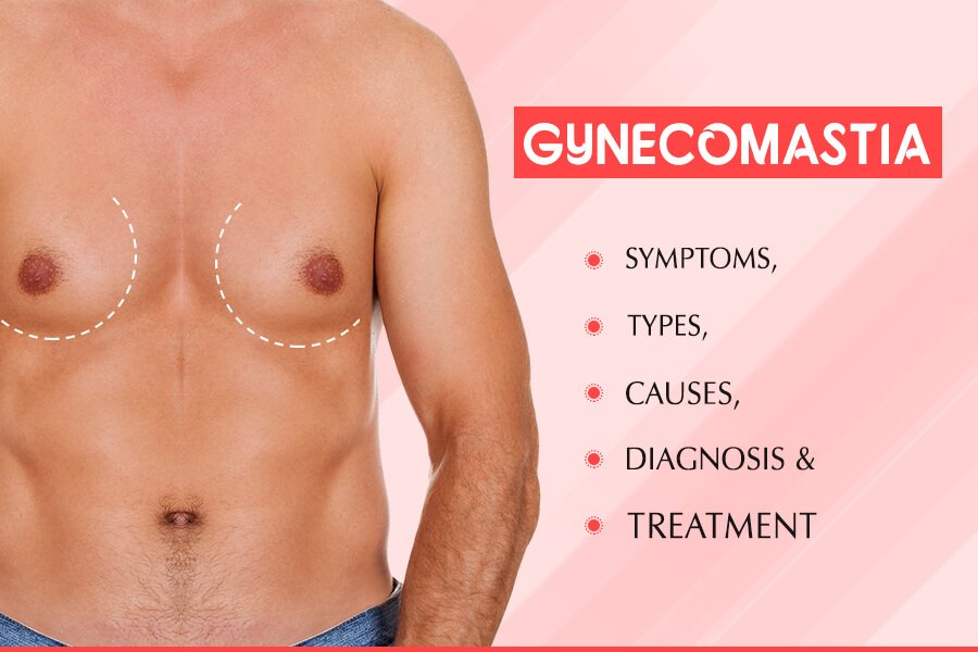 Mild Gynecomastia Symptoms - Type 1 Gynecomastia