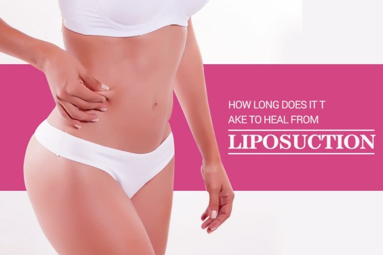 How Long Does It Take to Heal from Liposuction? Home