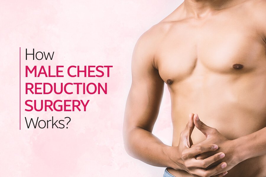 How Male Chest Reduction Surgery Works
