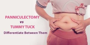 mini tummy tuck vs panniculectomy