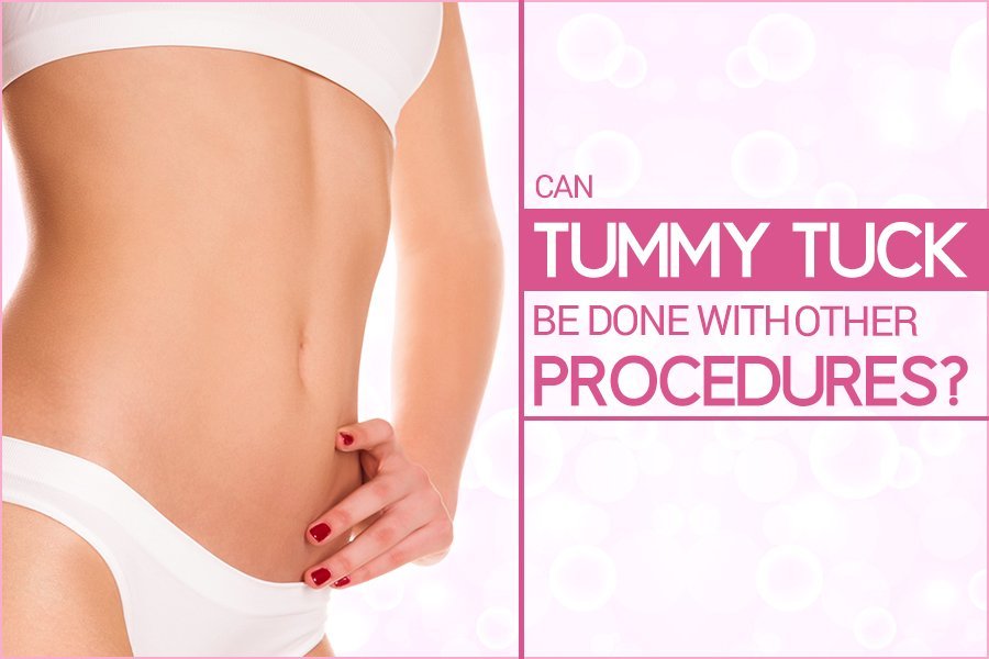 Tummy Tuck be Done with Other Procedures