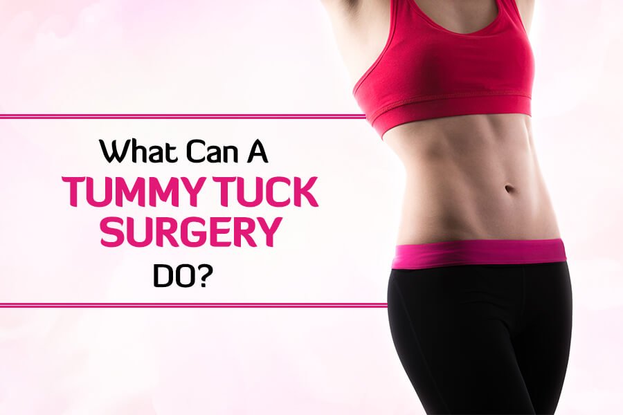 How to Prepare for a Tummy Tuck Procedure